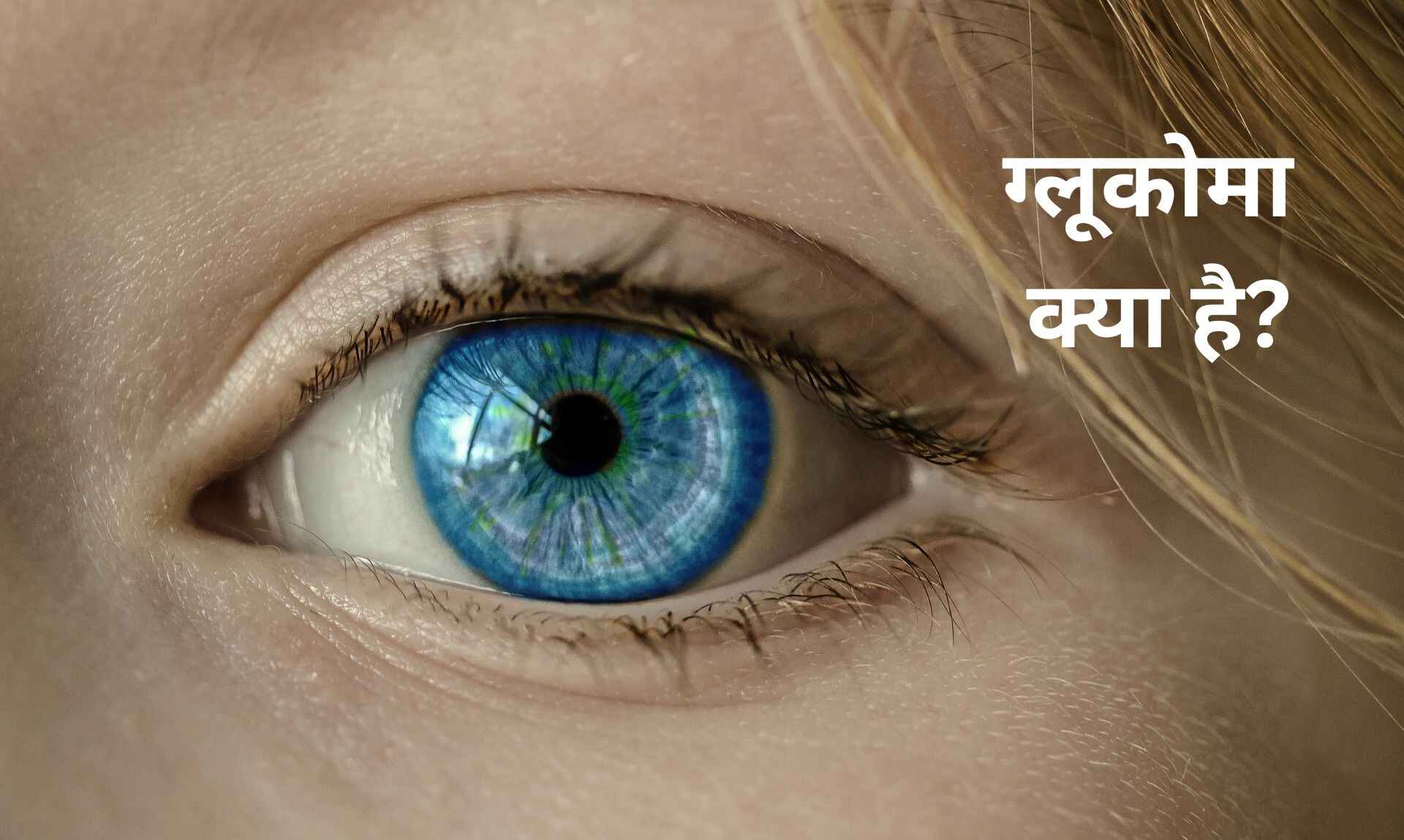 ग्लूकोमा क्या है?