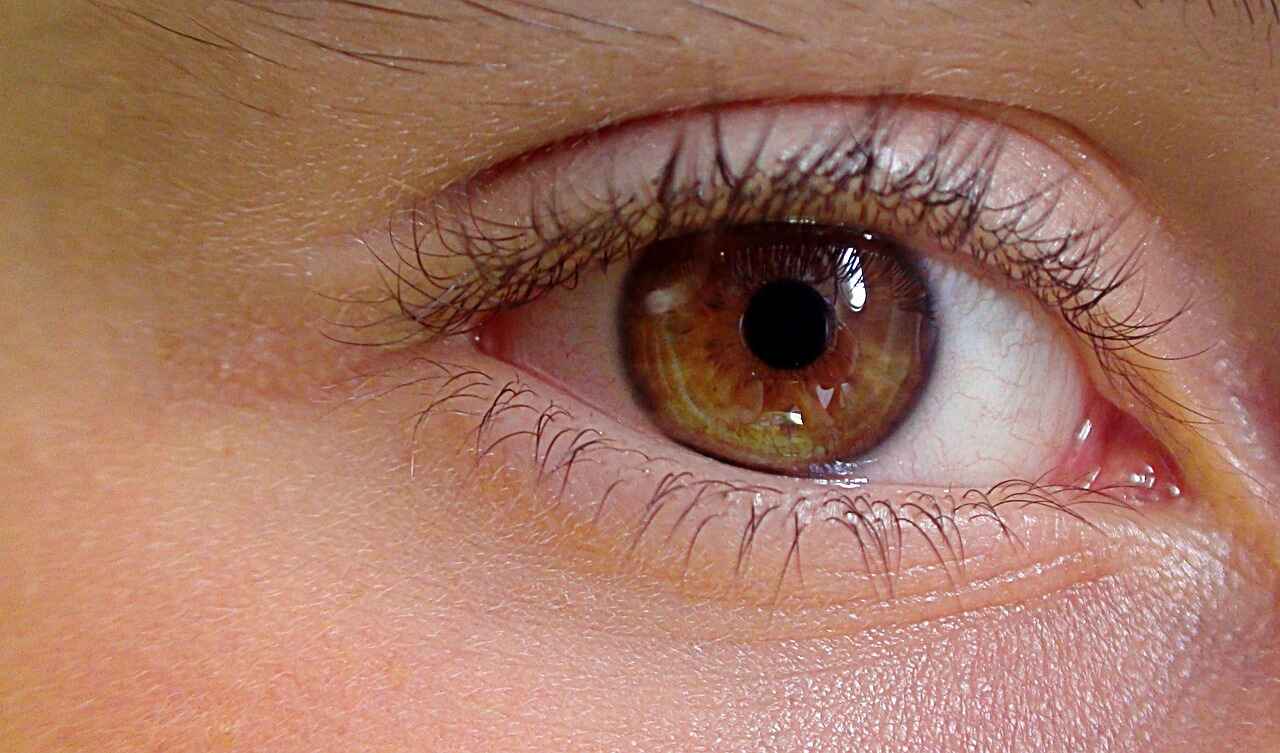 Eye Flu Kaise Hota Hai
